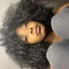 @14922560