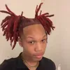 @fever._.3