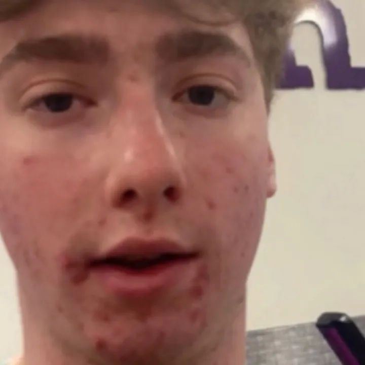 @walllmrt_lipgallagher