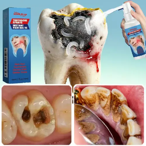 Oral Care Spray – Preventing tooth sensitivity, Relieving swollen and inflamed gums, Helping reduce tooth decay, Gentle formula for daily use