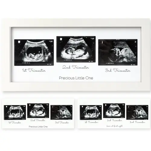 KeaBabies Baby Sonogram Picture Frames - Trio Ultrasound Picture Frames, First Time Mom Gift, Cute Pregnancy Reveal Photo Frame, Baby Gender Reveal Gift, Newborn Nursery Decor