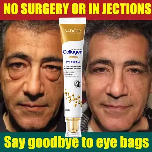 Instant Collagen Eye Cream, Dark Circles Treatment, Anti-Wrinkle Solution for Fine Line Fading, Skin Firming & Puffiness Relief, Brightening Eye Care, Anti Wrinkle Eye Treatments