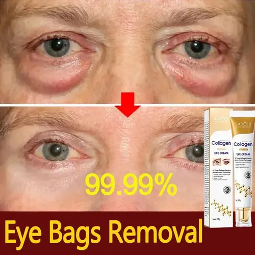 Collagen Eye Cream, Instant Eye Bag Removal Moisturizer with Smooth, Hydrating, Repairing Effects to Fight Dark Circles, Puffiness, Wrinkles, Fine Lines and Brighten Skin, Collagen Repair, Beauty Products