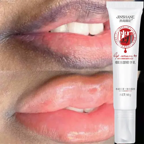 Gentle Lip Treatment Balm, Intensive Repairing Moisturizer for Dry, Chapped Lips - Day & Night Formula to Even Tone & Boost Radiance, Lip Moisturizer