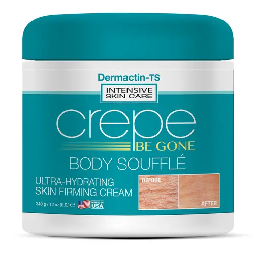 Crepe Be Gone Classic Body Soufflé - New Larger 12 ounce Hydrating Moisturizing Body Care Cream