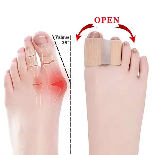 2pcs Silicone Toe Separators - Unisex Adult Bunion Corrector with Flexible Sleeves, Foot Support for Walking Protection, All-Day Comfort | Home & Party Gift Supplies for Those Seeking Bunion Relief to Manage Discomfort