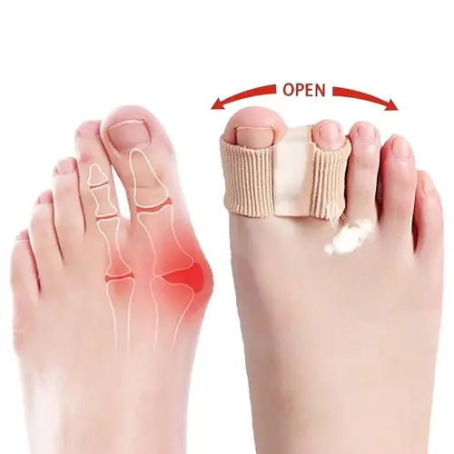 Silicone Toe Separators for Bunion Relief -springtok , All-DayComfort for Walking, Running, Hiking | Bunion Corrector &Toe Sleeves Healthcare