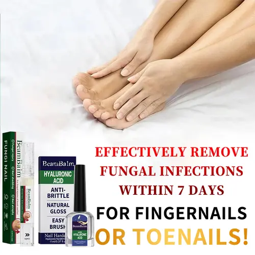 BEAMBALM Antifungal Nail Therapy Solution for Toenails & Fingernails - Strong Fungus Removal, Infection Prevention, Damaged Nail Repair & Renewal