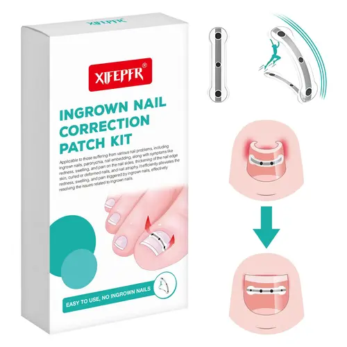 South Moon Mild Ingrown Toenail Treatment Patch Set, Pro Nail Care Kit with Titanium Alloy Corrector, 0.59"-0.67" Sizes, Tools for Curved Nail Repair, Pain Relief & Toenail Removal, Repairing