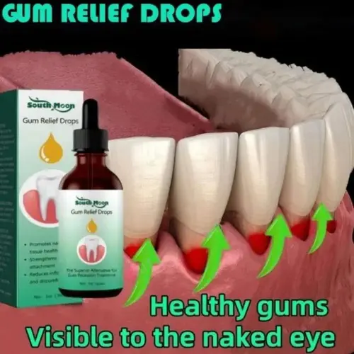 Gum Repair Drops with Aloe Freshness - 30ml Oral Care Cleansing Treatment for Receding & Swelling Relief, Stain Removal, Dental Cleaning Solution, Storage, Cleanser, Oral Rinse, Brightening