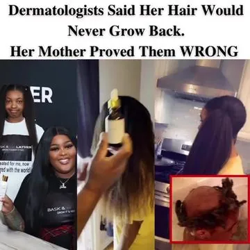 Join us live to get to know the GLOBAL brand serving 200,000+ customers and changing lives! Let us help you grow your hair and keep it too! Related:  1. How to grow hair  2. How to grow 4C hair  3. How to treat alopecia  #hairhealth #healthyhairtips #selfcaressentials #alopeciaawareness #hairlossspecialist #hairlosssolution #hairlossremedy #hairgrowthserum #hairgrowthoil 