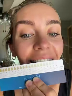 Follow along as i get to a one 🤪 #teethwhitening #teethwhiteninghack #tiktokmademebuyit 