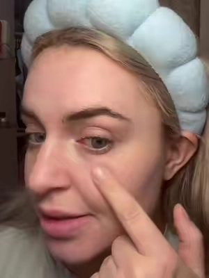 Replying to @T yessss. I look back at my before pictures and im just so impressed on all the plumpness that has gone back into my skin #koreanskincare #undereyecream #TikTokMadeMeBuylt #skincaremusthaves #undereyebags #undereyecircles #koreanskincareproducts #skincareroutine #musthaves #fyp #beforeandafter 