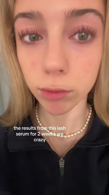 thickened them so much #fyp #lashes #lashserum