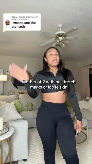 Replying to @Miss pretty pretty shop heres a mother of 2 stomach reveal #TikTokMadeMeBuyIt #stretchmarks #stretchmarkremoval  