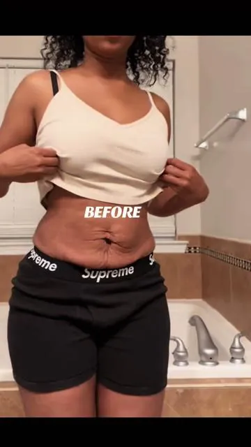 This is how i got firmer skin and faded my stretch marks as a mother of 2! I would def recommend for all postpartum moms! #postpregnancy #postpartum #looseskin #stretchmarks #skincaretips #skincaretiktok 