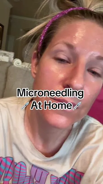 This product is in my top 3 best products found on Tiktok shop. The first use changed my skin appearance and im forever grateful for @medicube_official #liquidmicroneedling #medicube #microneedlingathome #exosomeshot #glassskin #firmskin #acnecare #koreanskincare #microneedling #tiktokshop #tiktokshopmademebuyit 