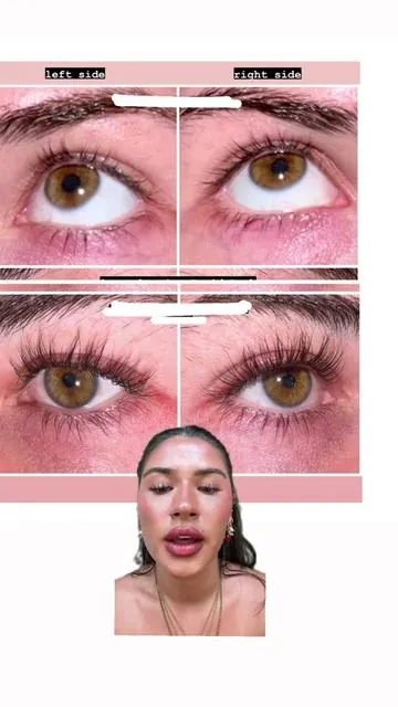 Best Lash Serums I’ve tried with before and after photos 