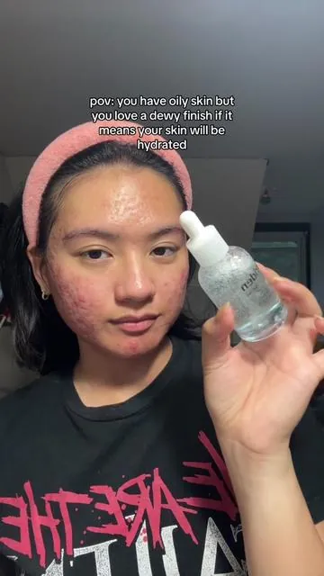 hyaluronic acid serum is such a basic product, but it’s so versatile and important for your skin 💦 it provides hydration, plumpness, retains moisture, and— if you also have oily skin —can help your skin manage oil product and reduce excess sebum over time 🙂‍↕️ #torriden #diveinserum #hyaluronicacid #hyaluronicacidserum #hydratedskin #dewyskin #glowyskin #basicskincare #everydayskincare #acneskin #acneproneskin #cysticacne #oilyskin #texturedskin #hormonalacne #acneawareness #acnejourney #acnecommunity #foryou #fypage #asian #filipino #newyork 