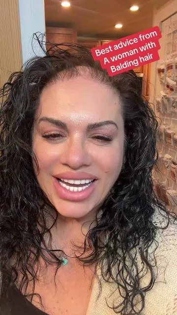 Best product for #balding #women #thinninghairsolution #losinghair #howtoconcealhairloss #hairlosssolutions #boldify #hairfibersforthinninghair #powder @@boldify 