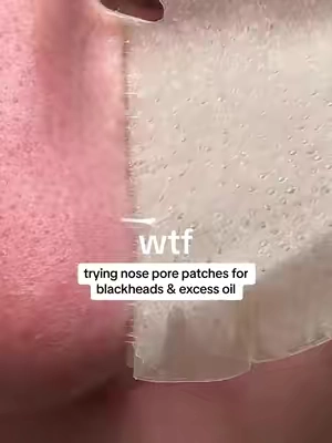 ok so gross yet satisfying #peachslices #peachslicesskincare #fyp #pimplepatch #noseporepatches #nosestrip #viralskincare #skincareroutine #skincare #skincarehacks #pores #porestrip 