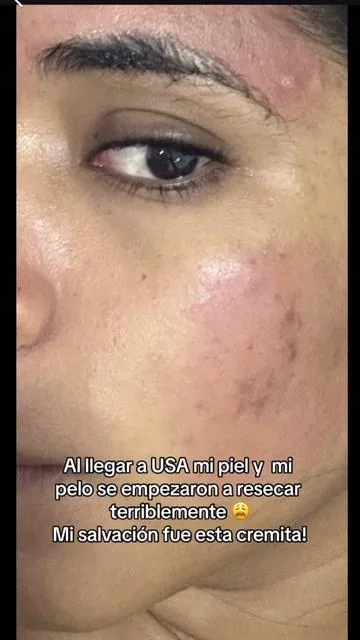 Amo demasiado la crema nocturna de Retinol de Olay, porque otros productos con retinol me resecaban mucho la piel, era muy fuertes para mí🥴 #skincare #latinasenusa #latinaenusa #venezolanaenusa🇻🇪🇺🇸 #mividaenusa #estadosunidos🇺🇸 #tiktokshop 