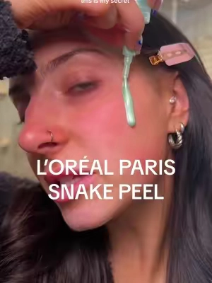 the results speak for themselves! 🧖🏼‍♀️The ultimate at home skincare solution from @loréal paris usa that works but is sensitive skin friendly! ✨#LorealParisPartner #snakepeel #LorealBrightReveal #exfoliation #skincare #acnescars #skincarerecommendation #skincareroutine