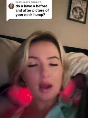 Replying to @Jo i hope this helps😭 this pic will haunt me lol & dont mind the tear in the neck massager my dog chewed it but it still works perfect 😂😂 #neckmassage #neckmassager #tiktokmademebuyit #relax #relaxation #massage 