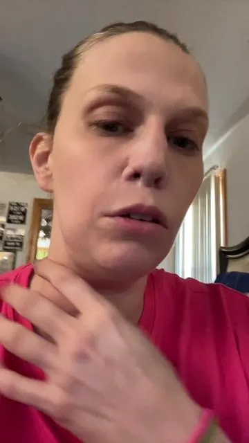 #gopure #gopureneckcream #dontdodrugs #fckaddicition #fyp #recovery #recoverytok #addictiondestroyslives #surgerytiktok #surgery #nosesurgery #foreheadflap #recoveryispossible #foreheadnose 