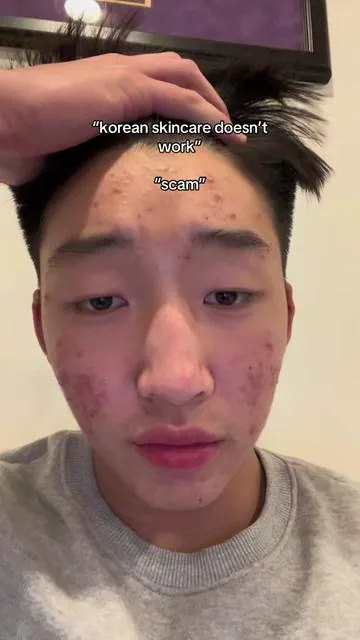 korean skincare really works, lowest price this year on tiktok shop #koreanskincare #mensskincare #skincare #tiktokshopblackfriday #blackfriday #anua #anuaskincare #skincareformen 