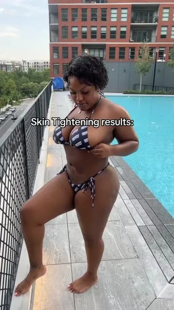 Here are the results of using @MAELYS Cosmetics overnight  toning whip!! No I don’t use it everday but I use it ~consistently~ and it really works!! I’m glad i put so many of you on🤎🤎  I’ll show more progress as I keep using it. #transformation 