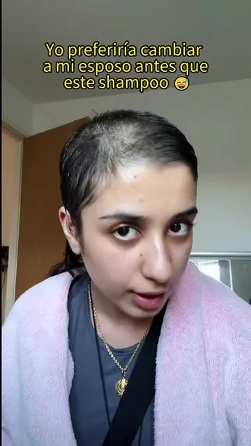 El #champú que me recomendó mi amigo doctor es realmente bueno. Los amigos con #caída de cabello severa deben probarlo.#hairgrowth #antihairfall #bald