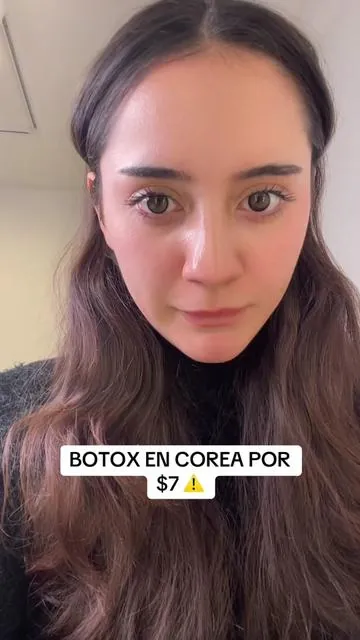 #koreanskincare #acne #acnetreatment #acneproneskin #ancetransformation #botox 