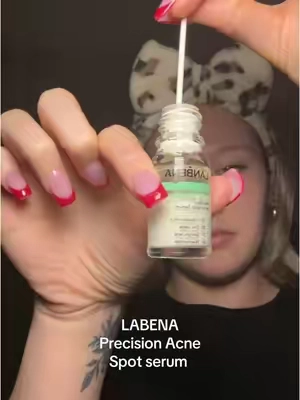 They showed off with the nose strips now this 😳🫶🏼 #acneskin #lanbena #acnefighter 