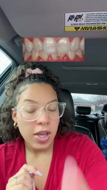 The only thing better than having smooth skin is having white teeth 🤩 #teethcare #teeth #teethwhiteningkit #smile #whiteteeth #oralcare #oralhealth #teethcare #teethcleaning #coffeedrinker #teadrinkers #vaping 