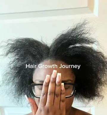 YALL GAME CHANGER!!!!!! My hair wouldn’t grow for nothing. If you take it consistently I promise it’ll get thicker and longer !! I’m about to order my 2nd bottle 