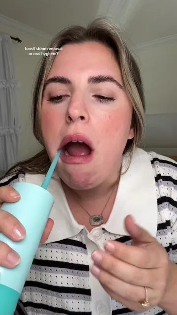 @The Bentist / Orthodontist 🦷 this water flosser/tonsil remover just changed my life! 🥹 @Something Nice Company  #waterflosser #tonsilstonesremoval #tonsilstone #flossing #teeth #teethcare #oralcare #plaqueremoval #tartarremoval #badbreath #oralhygiene #thebentist #waterflossing 