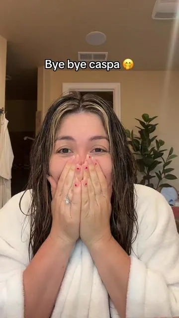 Bye bye caspa🤭💕 #haircare #simplymandys #hairloss #dandruff 