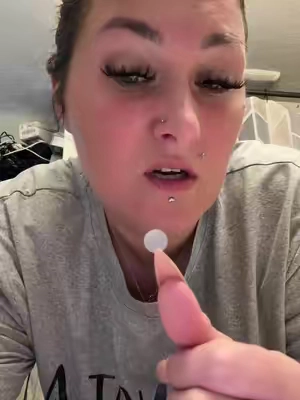 Love these pimple patches #pimplepopping #pimples #pimplepatches #beauty #acne 