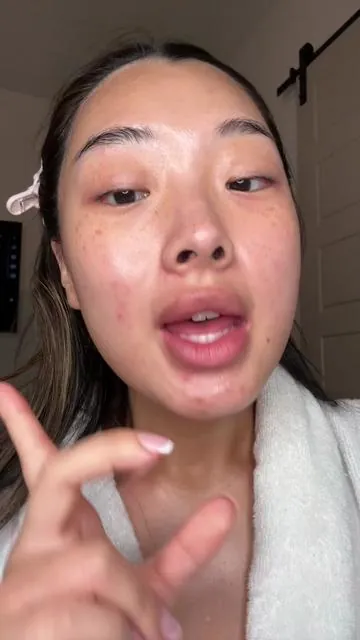 this is how I got rid of my nestle crunch bar skin #medicube #texturedskin #acne #acneprone #exfoliate #toner #skincare #koreanskincare #smoothskin #perfectskin #tiktokshoploveatfirstfind #tiktokshopspringglowup #springintohealth #beautyhacks #spotlightfinds #tiktokshopmothersday #tiktokshopmemorialday #glowyskin #kbeauty @Medicube Global 