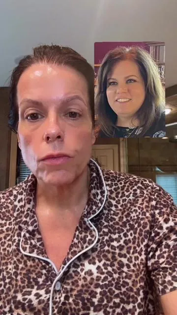 This neck tightening routine has been nothing shy of miraculous. I have been using the ampoules and cream for a little over a month now and the results are beyond amazing. Other products have temporary results and hydration but this product is actually thickening that skin. #drmelaxin #drmelaxinnecksphalt #necktightening #necktighteningcream✨ #neckskincare #neckskincareroutine #neckskinthickening #womenover40 #matureskincare @Dr.Melaxin 