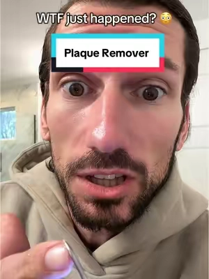 Plaque Removal Tool. #teethcare #teethcleaning #teethwhitening #dentalhygiene 