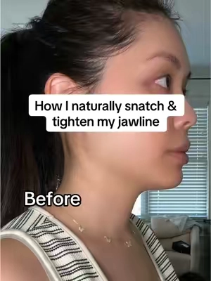 This chin and jaw strap is going to snatch & contour that jawline! I can’t get over how sharp my side profile is! 😍 @JUSRON_official #jawline #jawlinecheck #doublechinreduction #vlineface 