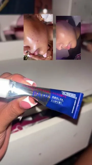 I literally found the cure for my random ass breakouts 😭 #breakouts #acne #koreanskincare #skincare #pimples 