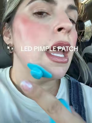 @rikilovesriki just changed the game for my hormonal acne! #hormonalacne #stressacne #cysticacne #ledpimplepatch 