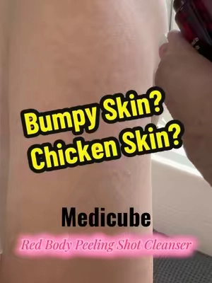 @Medicube Global @medicube_us #TikTokShopSpringGlowUp #TikTokShopCreatorPicks #tiktokshopcreatorpicks #spotlight #us #bumpyskin 
