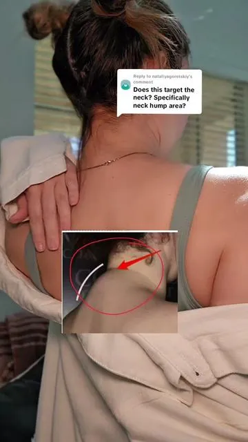 Replying to @nataliyagoretskiy This helps loosen all the tight muscles in the upper back that contribute to the neck hump.  #neckandbackmassager  #neckmassager  #neckandshouldermassage  #techneck #neckhump #neckhumpfix #technecksolutions #massager #upperbackpain  #tiktokshoprestock #tiktokshopmothersday 