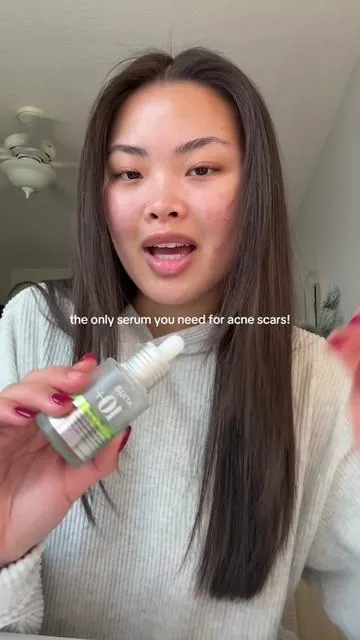 i just ran out of mine😭#creatorsearchinsights #tiktokshopspringsale #tiktokshopspringglowup #anua #anuazelaicacidserum #koreanskincare 