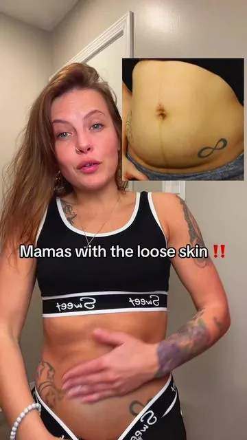 The results are crazy with this one mamas. #mombod #csection #toning #cellulite #bodypositivity #momsontiktok #maelys #firmingcream #looseskin #springintohealth 