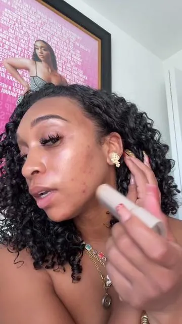 Acne ain’t stopping no show!!! Happy Easter bookies 💛